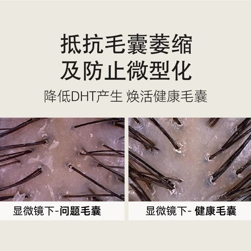 海瑟薇 HASERVEY生姜洗发水控油去屑强韧柔顺氨基酸护发素套装蓬松男女士洗头膏 生姜健发洗发水(控油蓬松)460ml