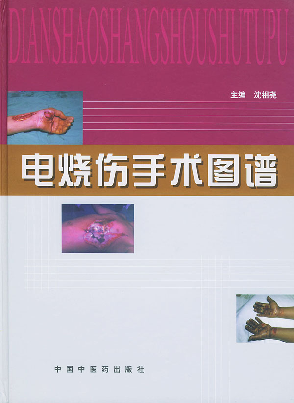 电烧伤手术图谱【正版图书】