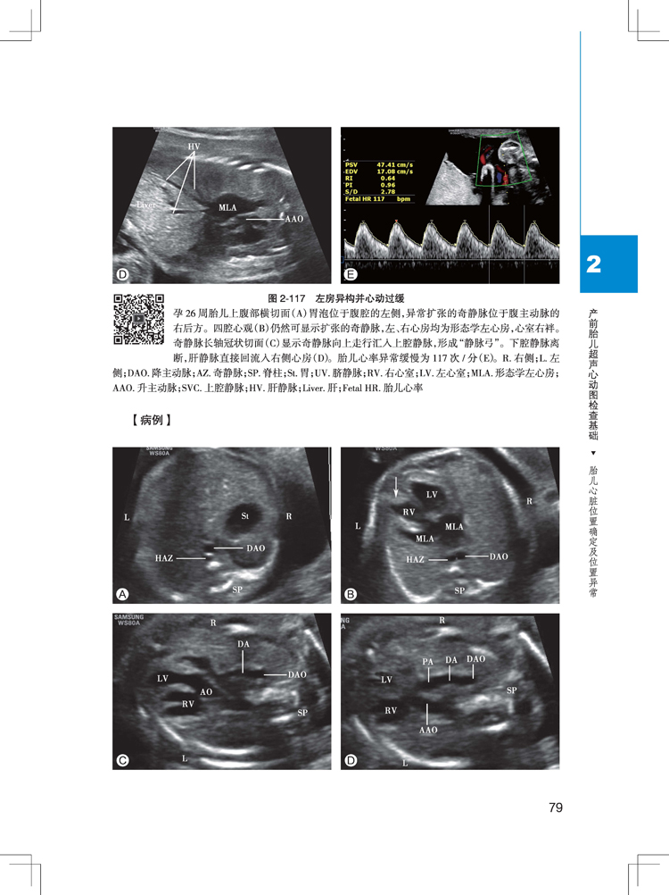 第二版 影像诊医学儿科学 于岚主编 胎儿超声心动图学指南手册 放射