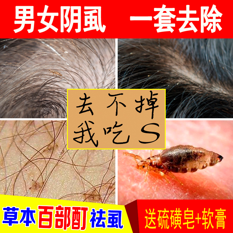 阴虱净阴虱一扫光私处去阴虱男士女私处瘙痒百部酊灭