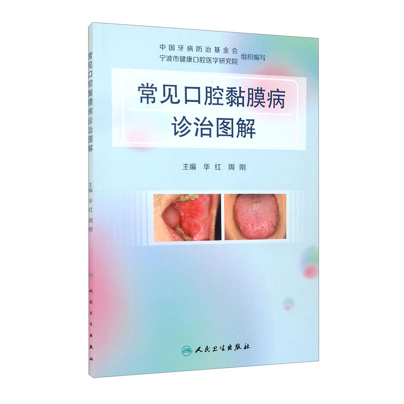 [正版图书]常见口腔黏膜病诊治图解
