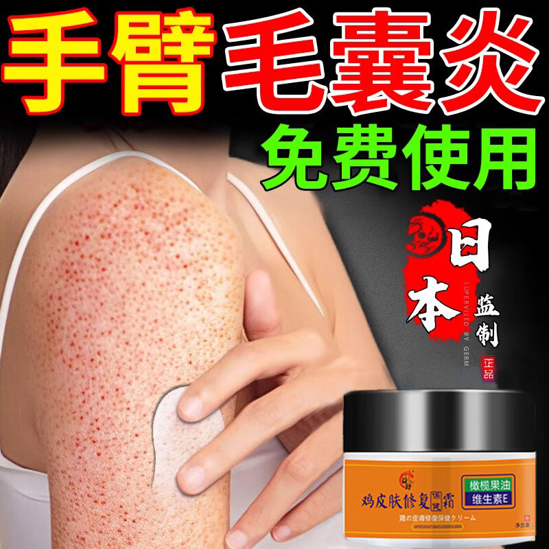 鸡皮肤疙瘩毛囊角化症专用膏药 去看鸡皮肤毛囊角质疙瘩大腿手臂 1