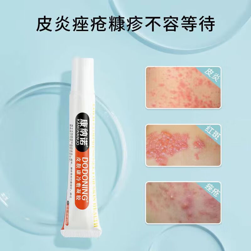xiuse德国tftbs湿清霜康纳诺dodoning皮肤康冷敷凝胶皮肤湿清霜瘙痒膏