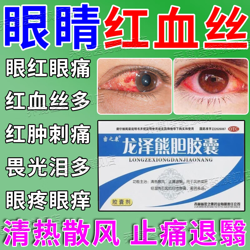 龙泽熊胆胶囊 治红眼病口服药 风热肝经湿热引起的眼睛上火目赤肿痛眼