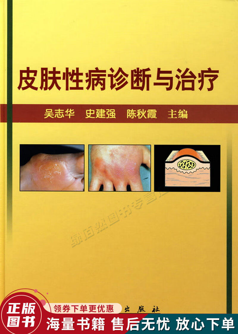 皮肤性病诊断与治疗