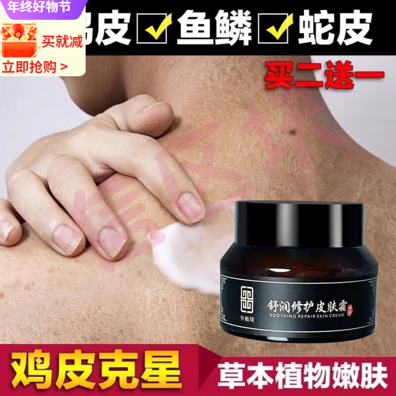 又困又起鸡皮疙瘩(一到晚上就起鸡皮疙瘩) 又困又起鸡皮疙瘩(一到晚上就起鸡皮疙瘩)