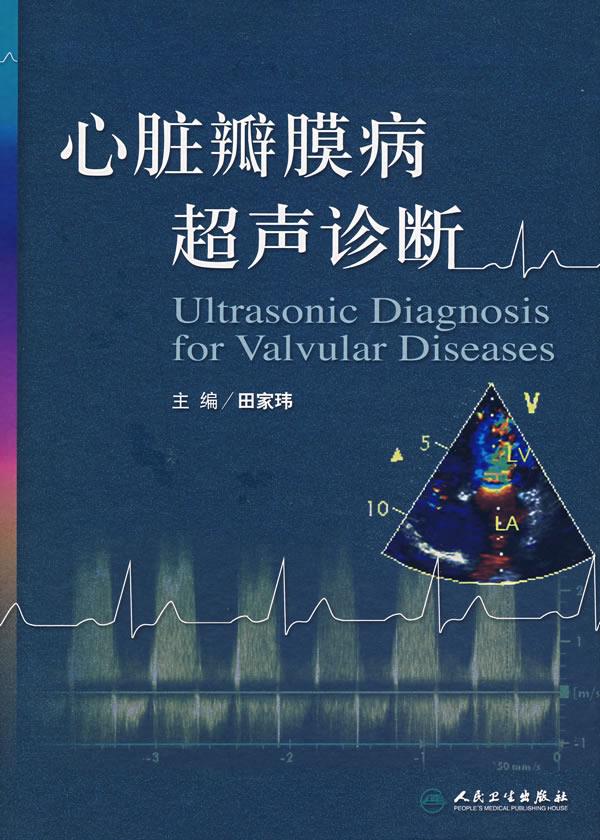 心脏瓣膜病超声诊断