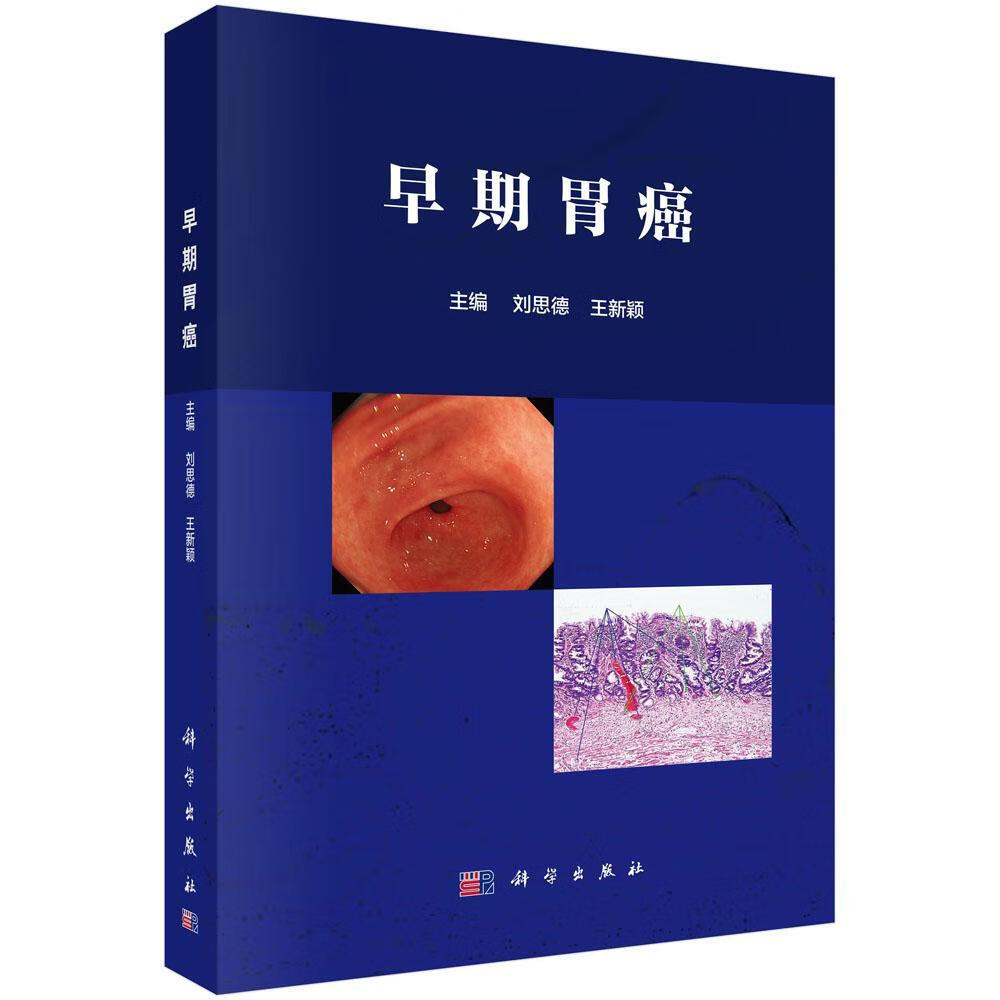 早期胃癌刘思德医学9787030563668