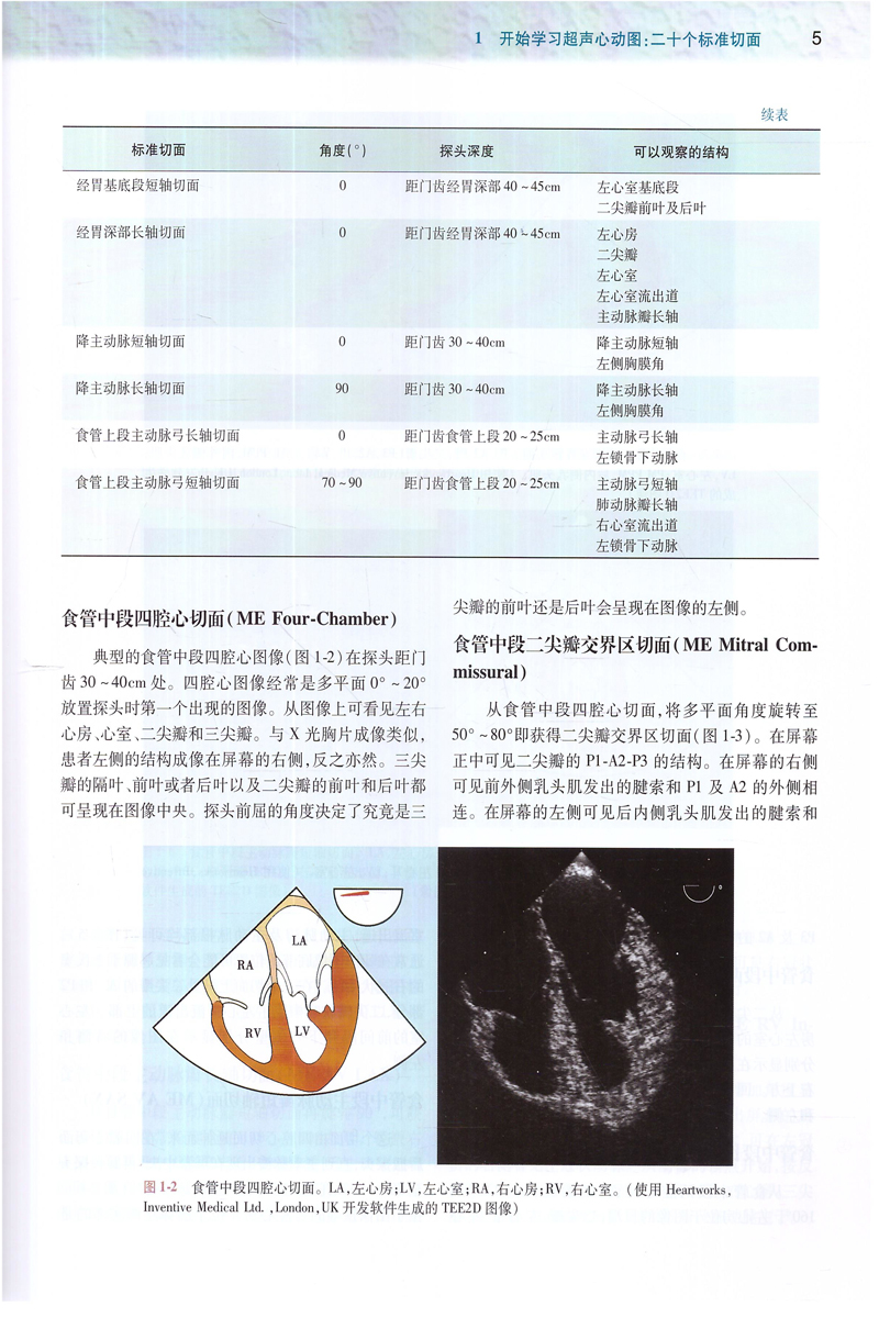 于晖王晟宋海波彭勇刚主译 二维经食道超声心动图临床麻醉学书籍中文