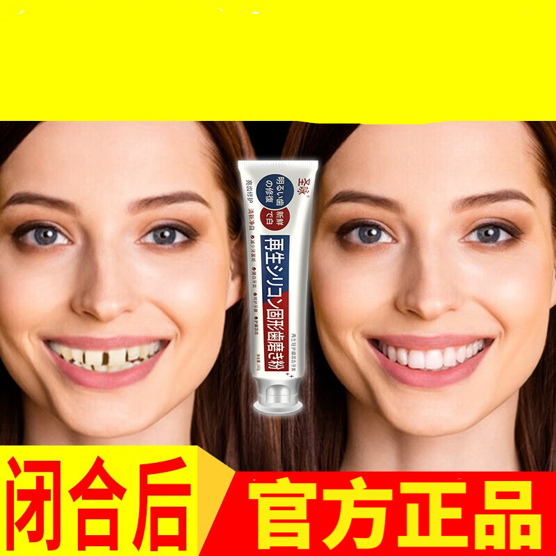 牙齿修复填充牙缝刷填充补牙神器牙间隙大填充剂牙缝大宽修复护理 三