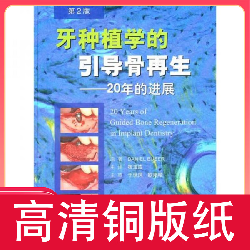 牙种植学的引导骨再生 20年的进展(第二版) 铜版纸