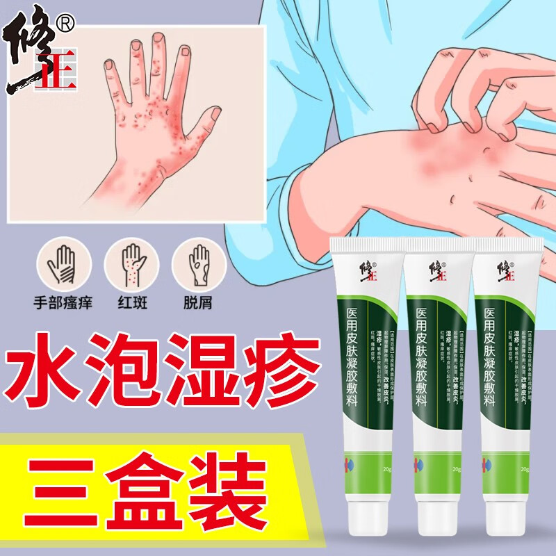 手痒发红起小水泡湿疹抑菌膏手痒手指手部湿疹专用皮肤干燥瘙痒脱皮