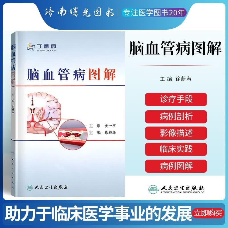正版现货 脑血管病图解 徐蔚海 临床实用脑血管治疗学医学工具书籍可搭脑血管病和神经介入技术手册中国管理指南 人民卫生出版社