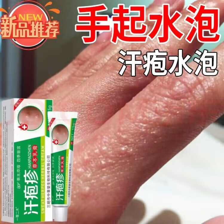 一草二木汗l疱l疹手上起小水泡手痒手脚脱皮干裂手足l藓真菌感染 买3+2【五盒巩固装】