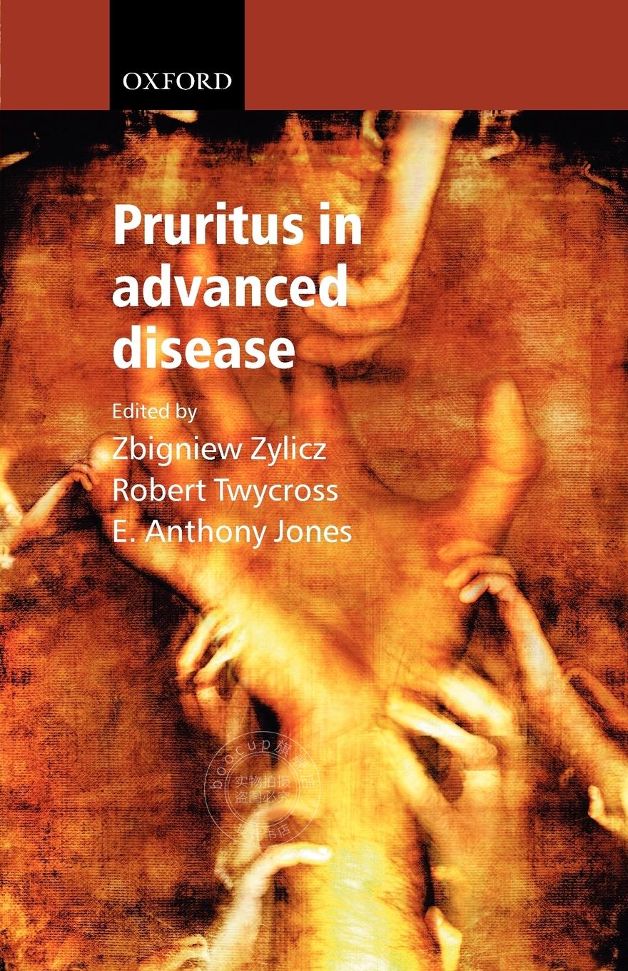 【2周达】【预售 按需印刷】pruritus in advanced disease