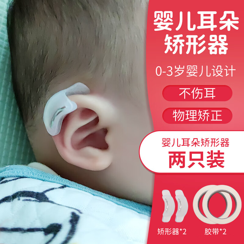 耳朵矫正器 新生儿耳廓耳朵夹矫正器婴儿耳撑耳形外耳内扣固定垂 耳朵