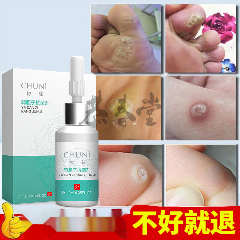 【药房直售】丝状尤小肉瘤肉猴子刺肉膏肉粒老鼠奶老鼠痣疙瘩