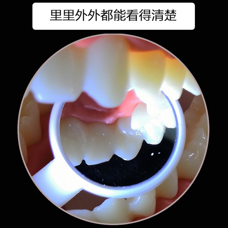 美鹦超声波洁牙器牙结石去除器牙龈下面的结石能清理吗？