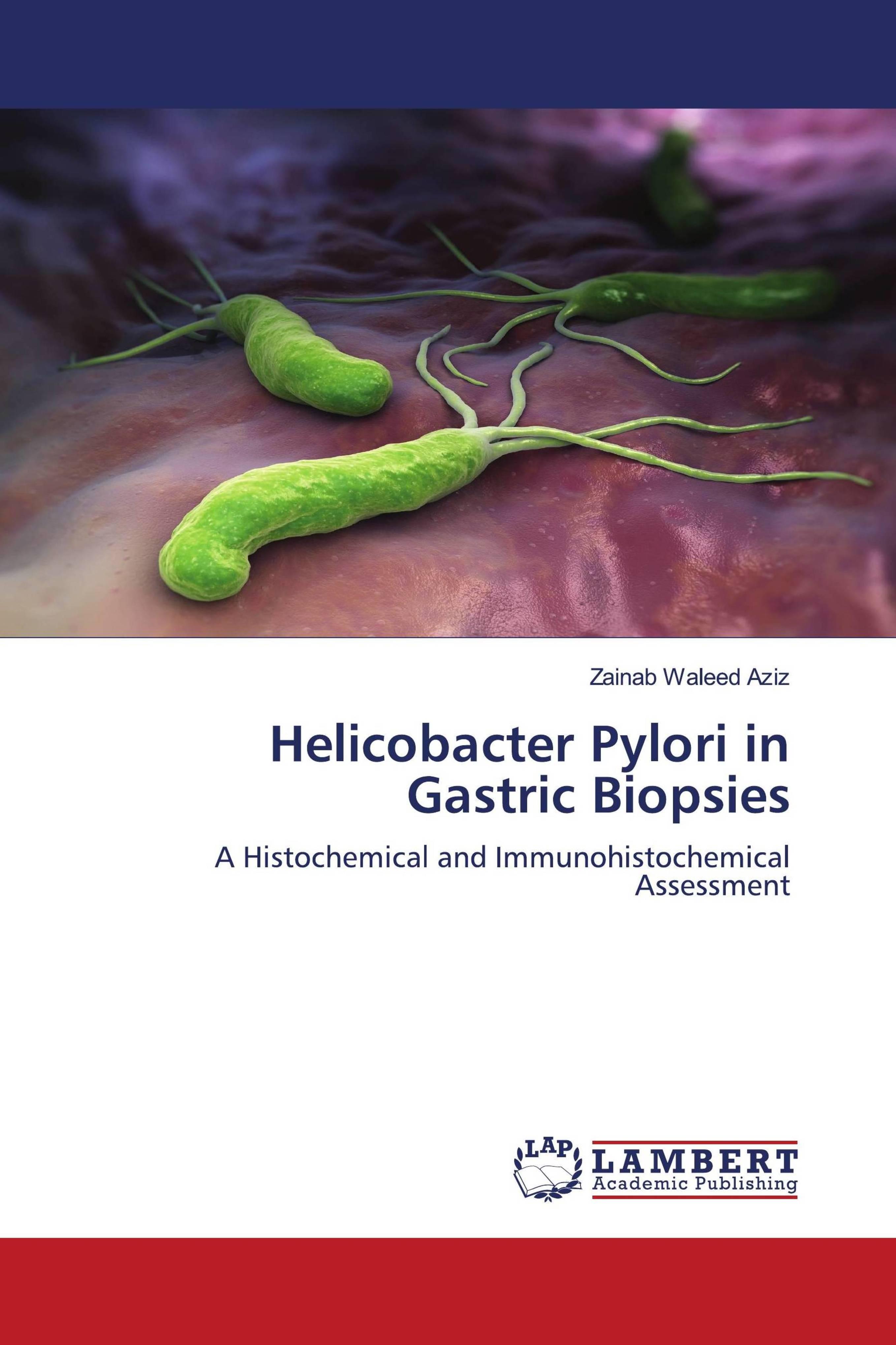 预订Helicobacter Pylori in Gastric Biopsies