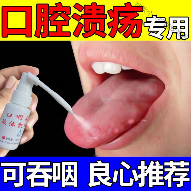 口腔喷雾(一喷修复)口腔溃疡喷剂复发性口疮舌疮嘴巴上火起泡痛烂嘴角