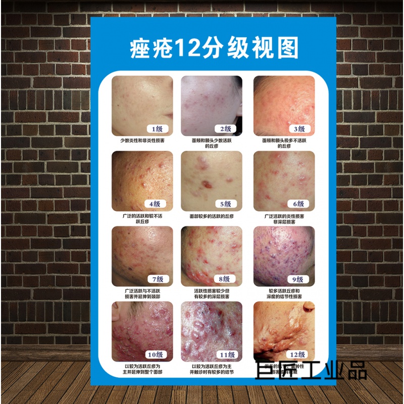 定制适用皮肤病墙贴纸皮肤疾病常见图谱医院皮肤科挂图宣传海报装饰画