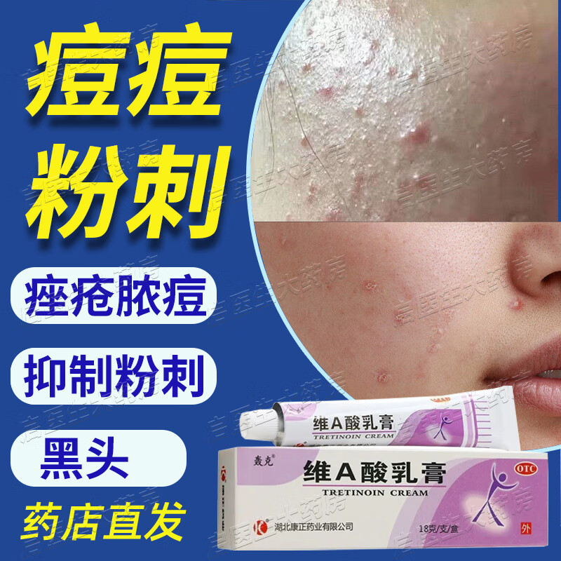 克痤隐酮酮凝胶乳膏可选类似功效维a酸乳膏18g祛痘去除粉刺黑头抑制