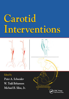 预订 carotid interventions