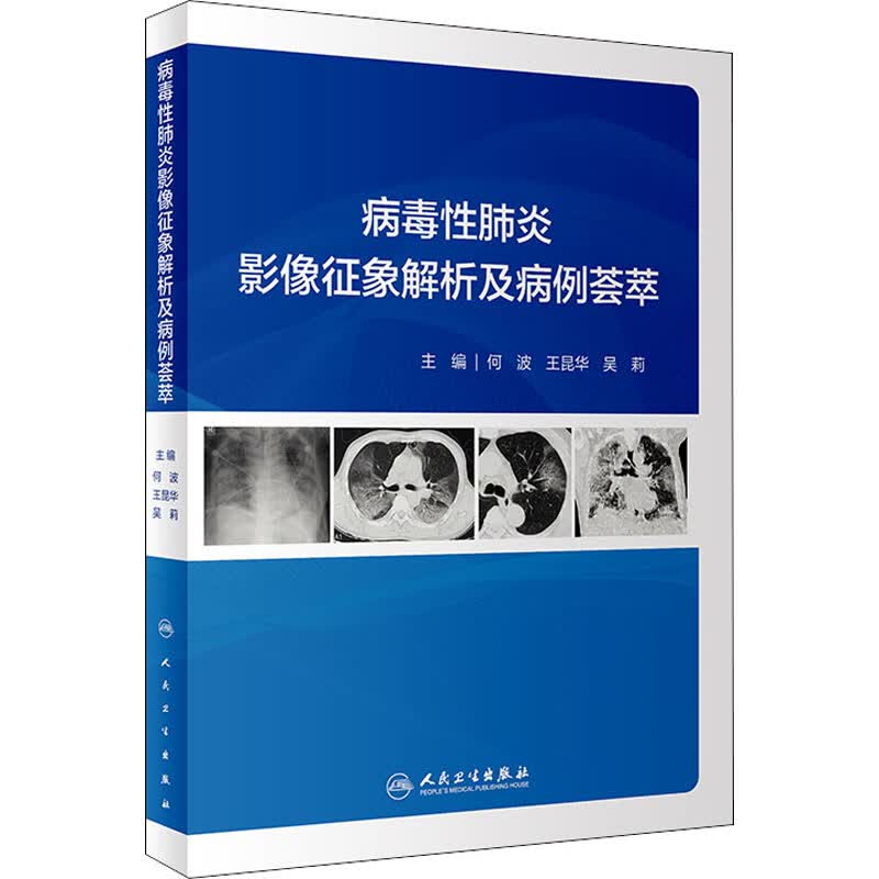 病毒性肺炎影像征象解析及病例荟萃 图书