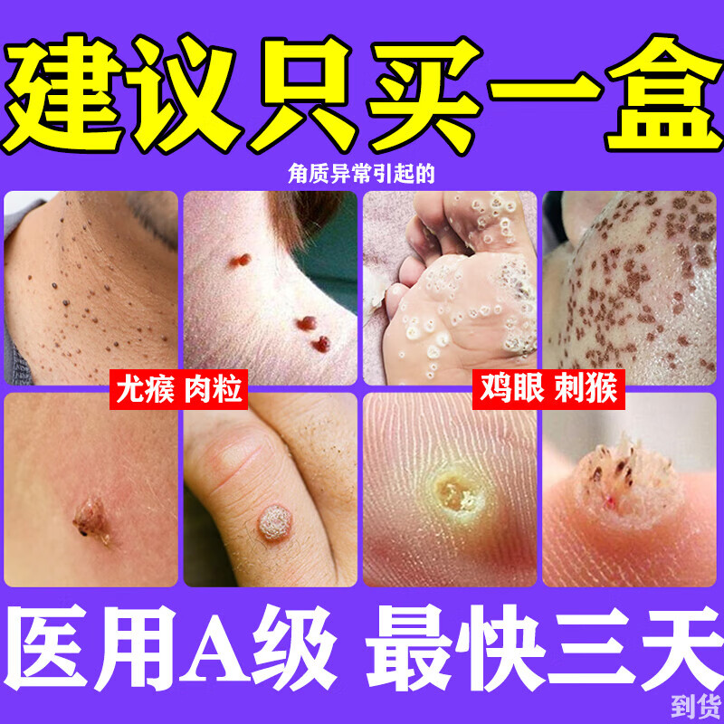 药脖子瘊子去疣灵猴子肉粒疙瘩脖子瘊子疣体脱落皮肤用药维a酸乳膏