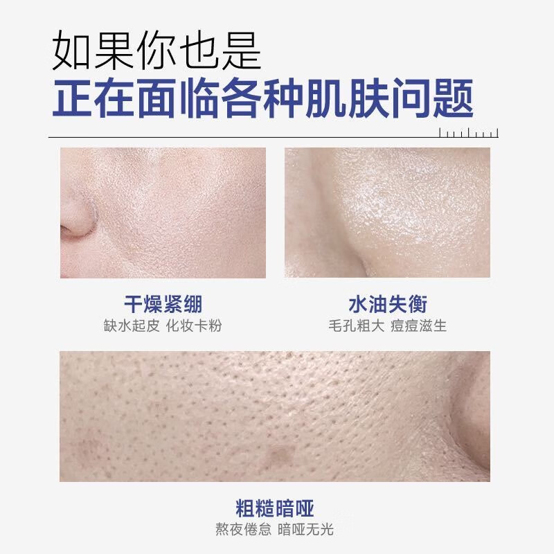 子氧肌底开肤露20ml*10支甘油保湿护肤品 20ml*10支 1盒装