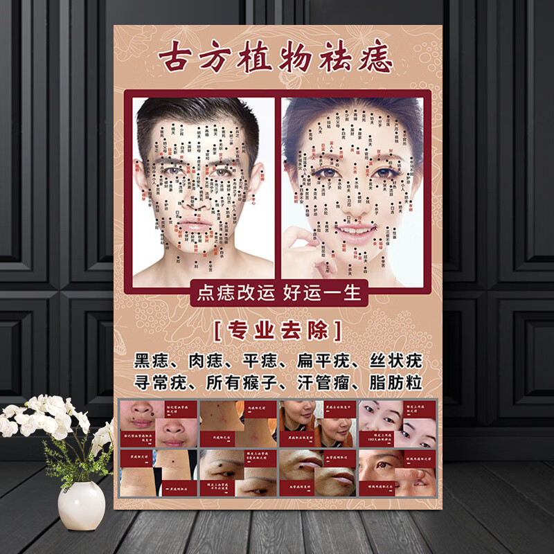 澳颜莱 男女面痣图 点痣宣传图海报男女面痣图祛痣广告去痣图片图解取