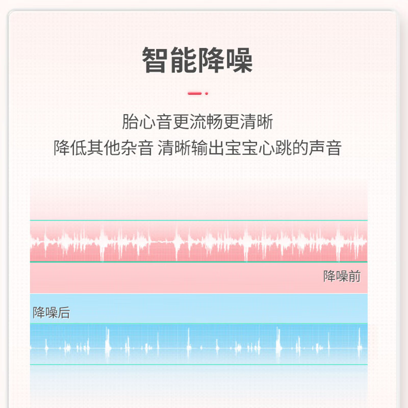 康泰CONTEC连续波多普勒胎心仪孕妇家用低噪磁吸探头测胎儿监护仪器胎监检测CONTEC10CL