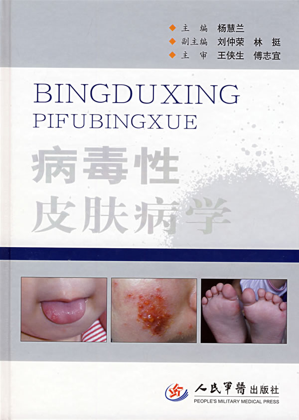 病毒性皮肤病学