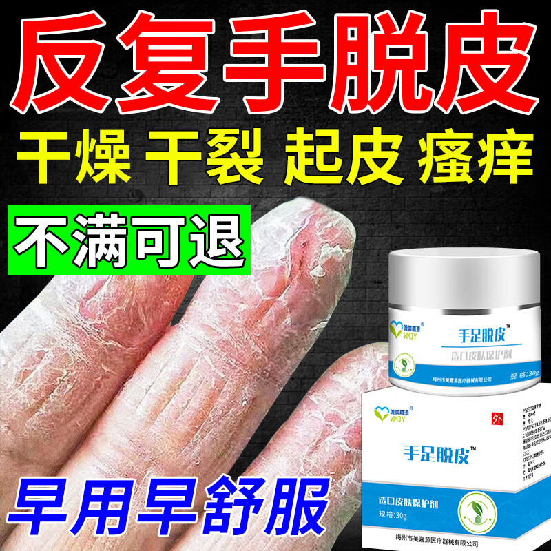手指脱皮真菌感染软膏季节性干燥起皮开裂发硬痒裂口倒刺手癣成人儿童