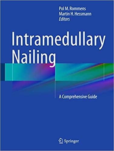 预订intramedullary nailing: a comprehensive guide