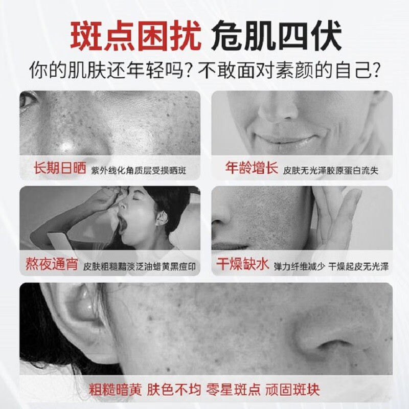 xovo377烟酰胺美白祛斑霜祛斑睡眠面膜免洗淡斑抗皱提亮肤色改善暗沉 美白祛斑霜*1 第3件零圆