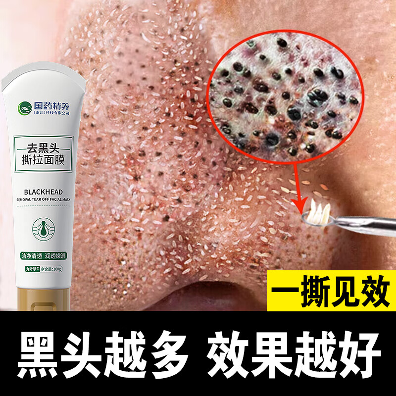 国药精养去黑头撕拉面膜修复毛孔收缩毛孔黑头清理粉刺涂抹式男女士100g