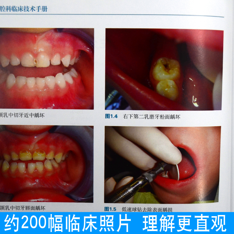 正版 儿童口腔科临床技术手册 儿童口腔牙齿疾病预防治疗拔牙镶牙手术