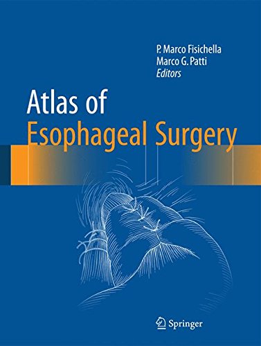 预订 atlas of esophageal surgery