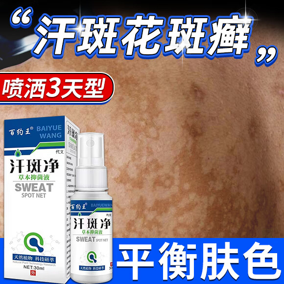 汗斑净 汗斑专用的药 成人汗斑花斑癣根除后背白斑糠疹股癣体癣汗斑净