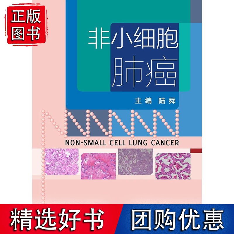 非小细胞肺癌(配增值)