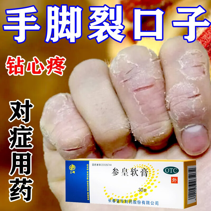 治皮肤干裂药膏 手裂脱皮脚后跟干裂皲裂干炎手指裂口子脱皮去死皮