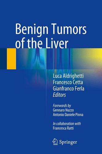 预订 benign tumors of the liver
