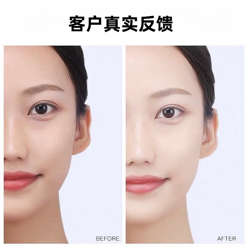 花木本草正品芦荟原液护肤品套装水乳补水保湿美白淡斑去黄抗皱紧致化妆品 草绿色 芦荟花木本草一套【五件套】