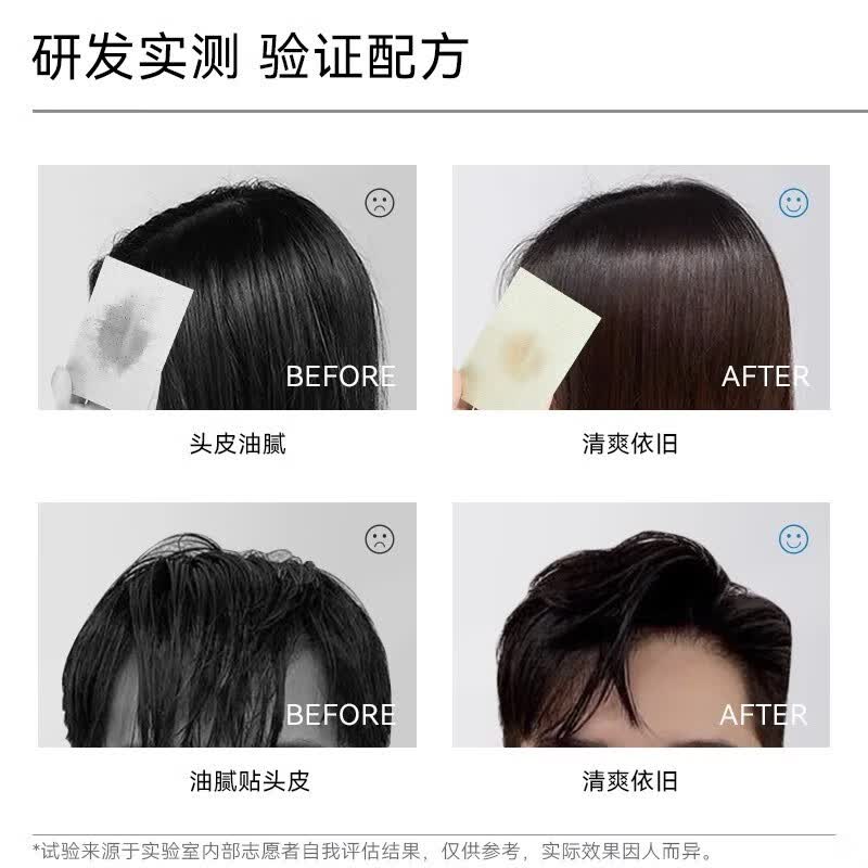 哈恩男士咖啡因洗发水油性发质清洁去屑护发洗发水哈嗯 哈恩咖啡因洗发水