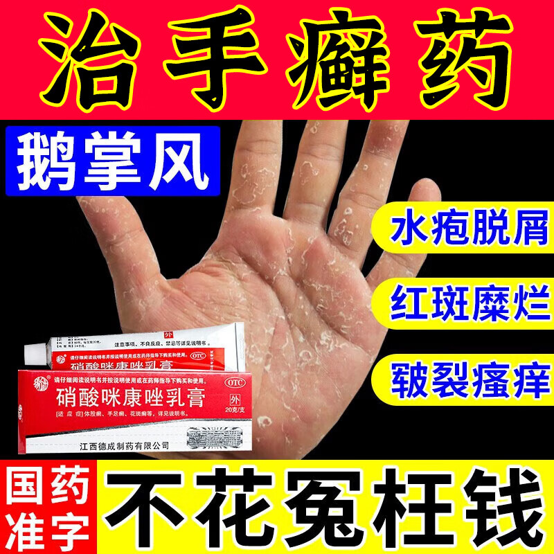 【治手足癣药】手癣真菌感染皮肤用药膏手脱皮用什么药手痒起小水泡