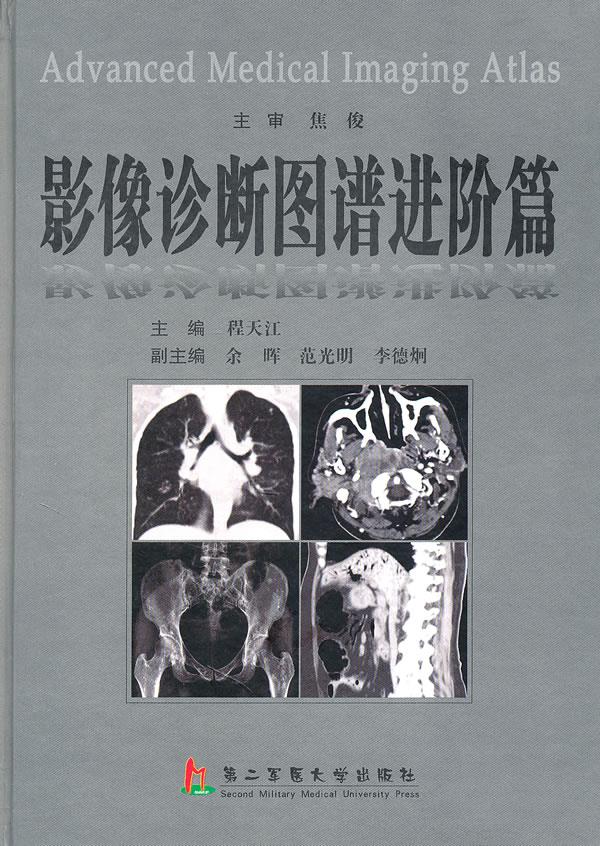 影像诊断图谱进阶篇【正版图书】