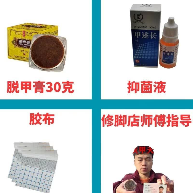 灰指甲脱甲膏软甲膏重度指甲空修脚店【去灰甲】 30克甲膏/*在线指导