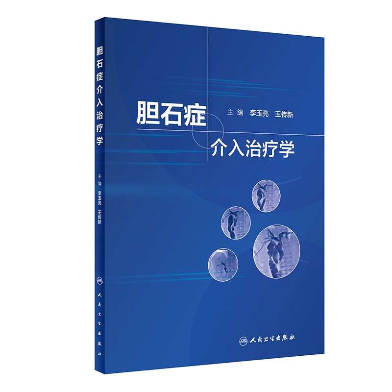 胆石症介入治疗学