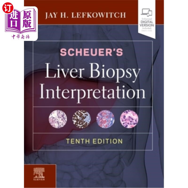 海外直订医药图书scheuers liver biopsy interpretation scheuer的